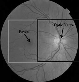 眼底图像示例，Fovea表示黄斑中央凹，Optic Nerve 表示视觉神经头