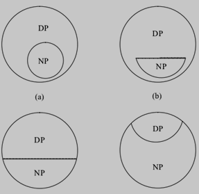 双光镜片的基本形式（DP为远视区，NP为近视区）