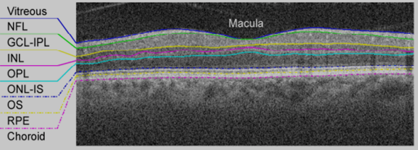 横截面SDOCT图像（B-scan）的七个视网膜层
